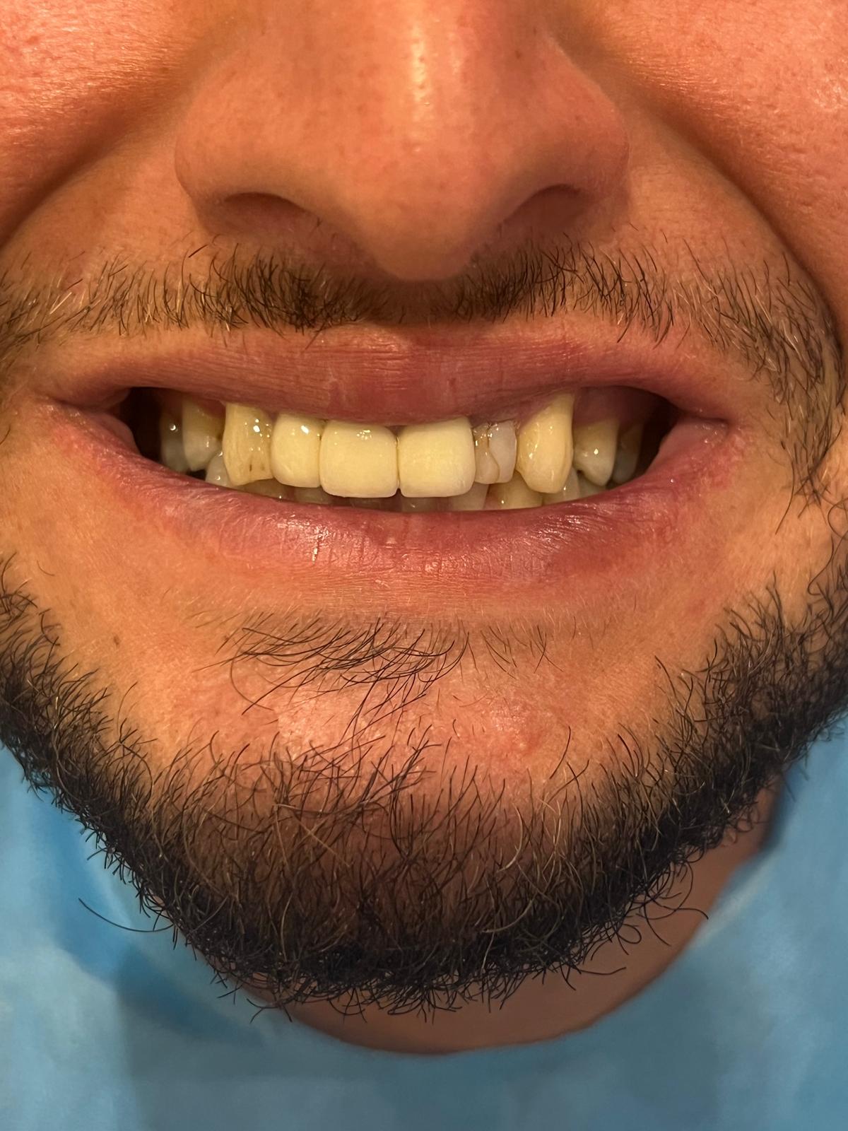 ECE Dental Patient Transformation
